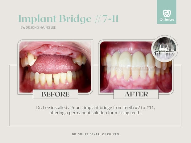 Images Dr Smilee Dental of Killeen, Family, Cosmetic, Implant, Medspa