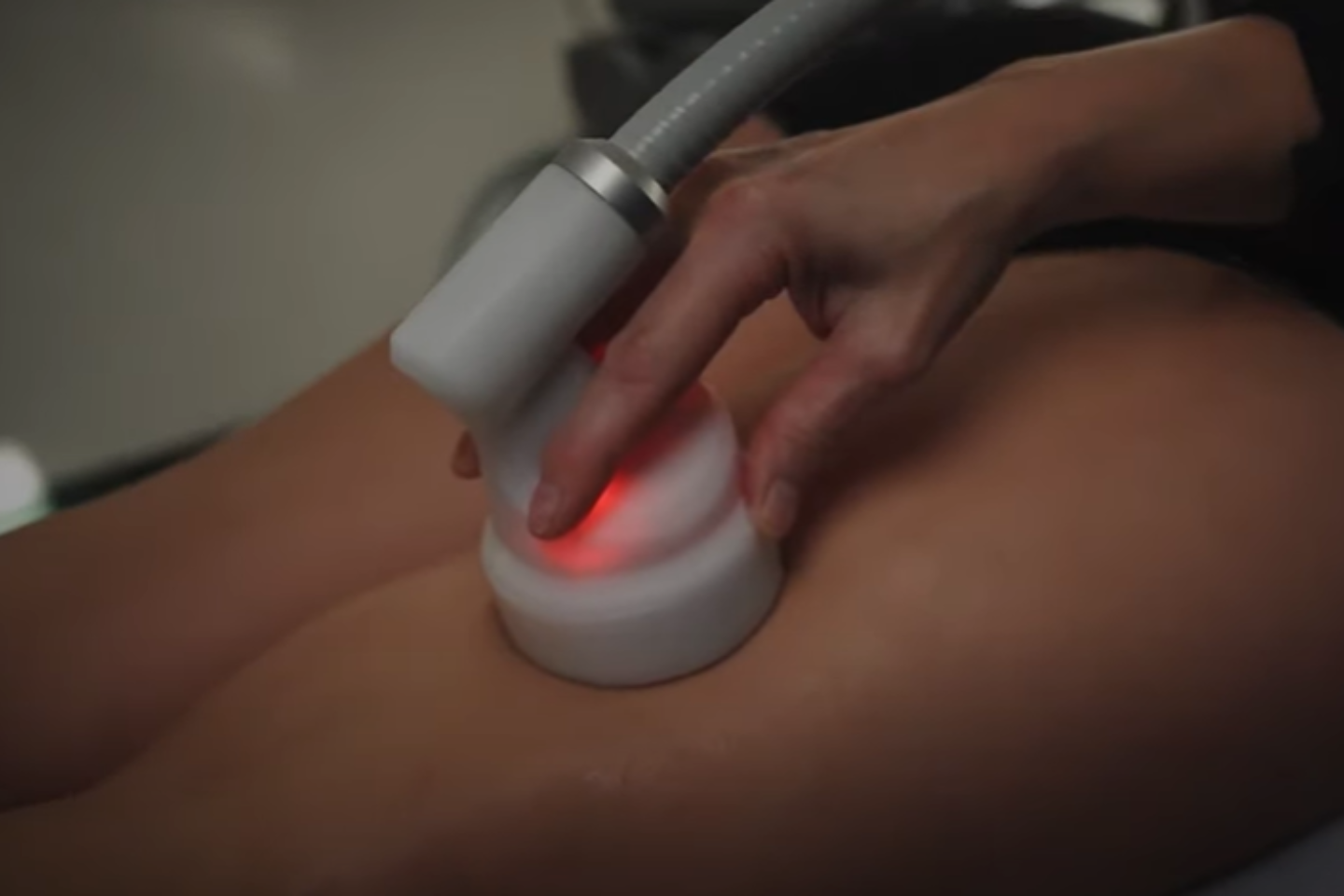 Cryotherapy