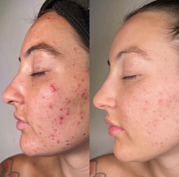 Images Face of Jules