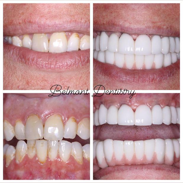 Images Belmont Dentistry Scottsdale