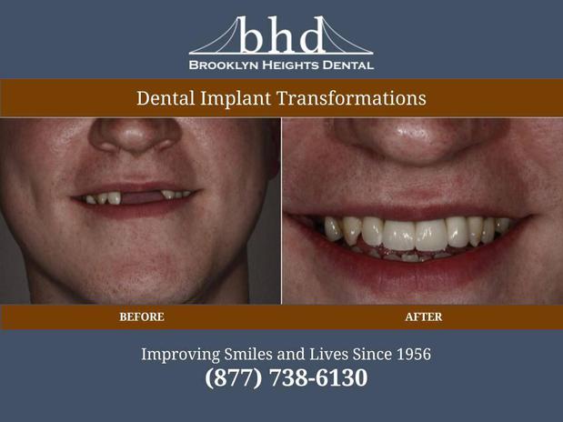 Images Brooklyn Heights Dental