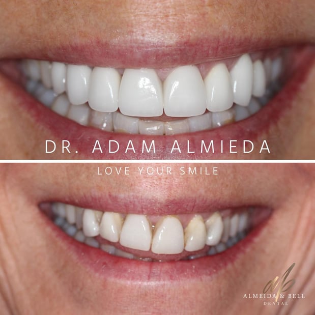 Images Almeida & Bell Dental Lone Tree - General, Cosmetic, and Implant Dentistry