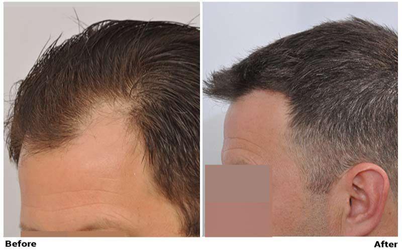 Images ForHair NYC Restoration Clinic - Dr. John Cole