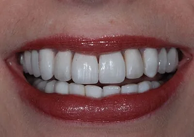 Images Smile Dental Laboratory