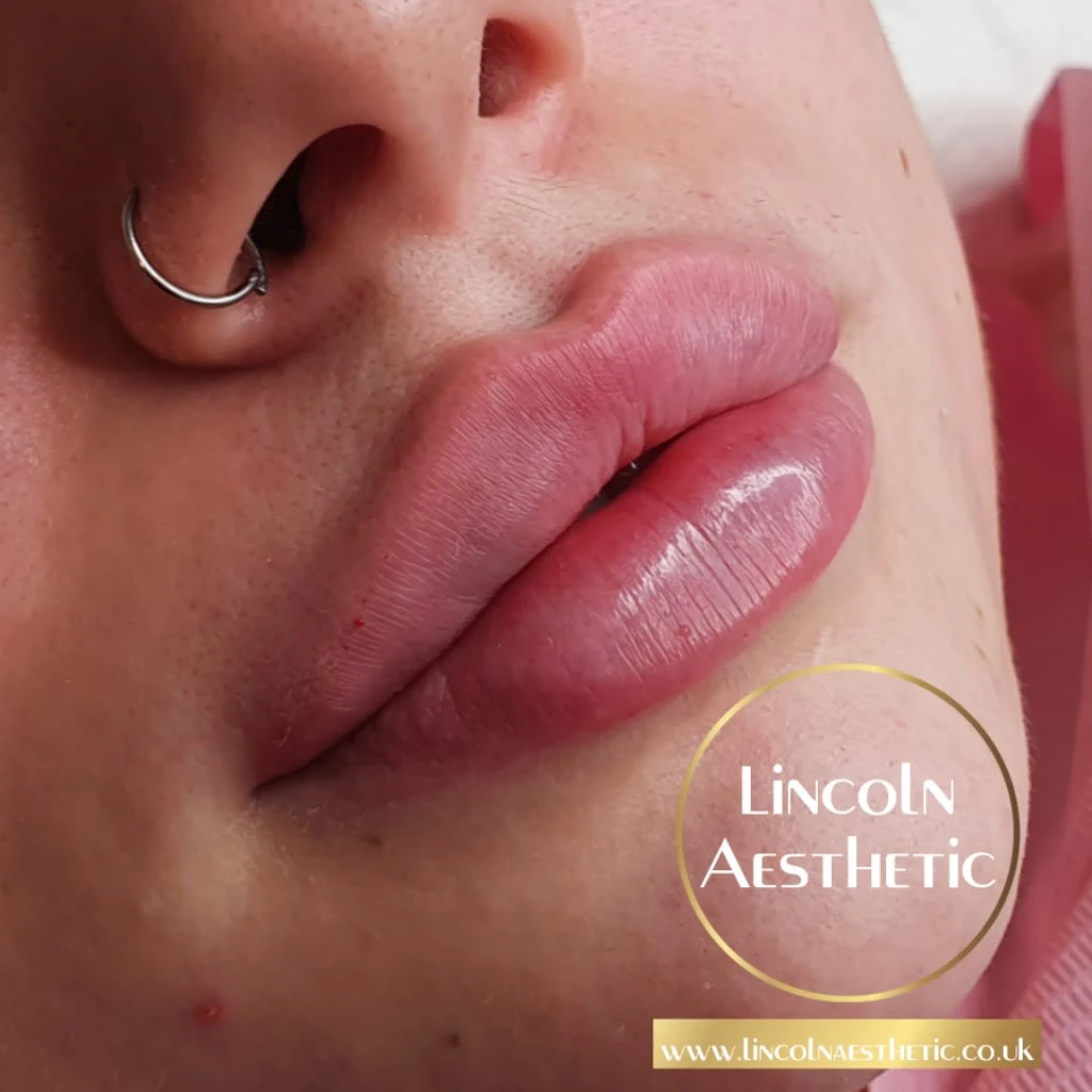 Images Lincoln Aesthetic