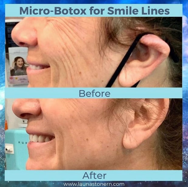 Images Launa Stone, R.N.