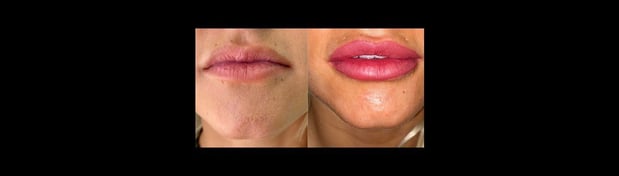 Images Pittsburgh Dental Spa