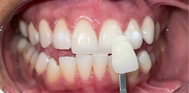 Images Enrich Dental