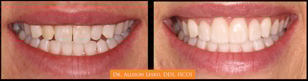 Images The Fort Collins Dentist Family and Implant Dentistry