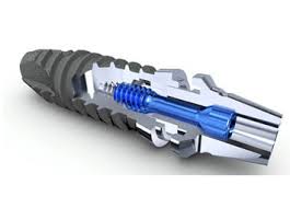 Zahnarztpraxis med. dent. Andreas Loboda, Alte Bahnhofstrasse 3 in Herisau