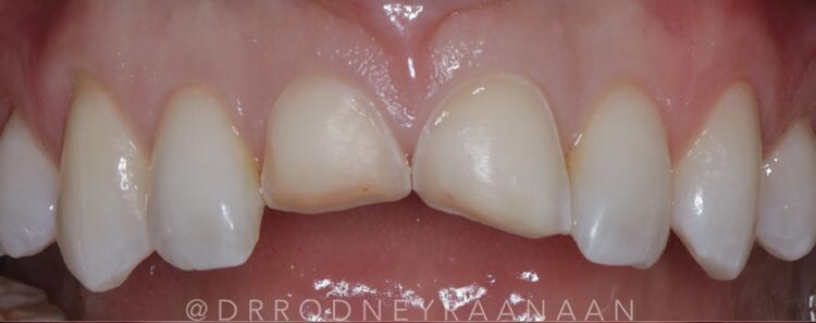 Images Dr. Rodney Raanan