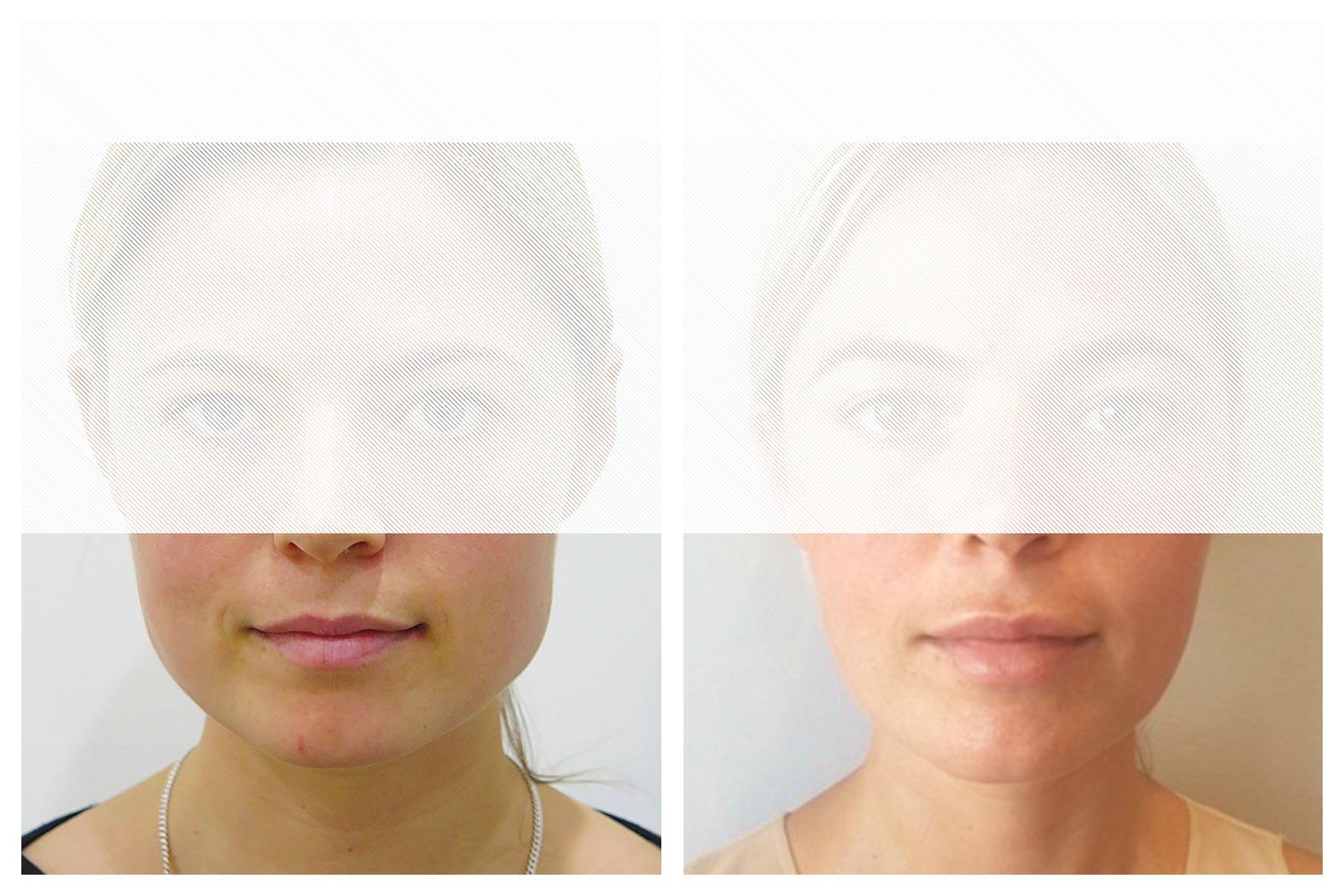 Images About Face Medical Aesthetics - Richmond