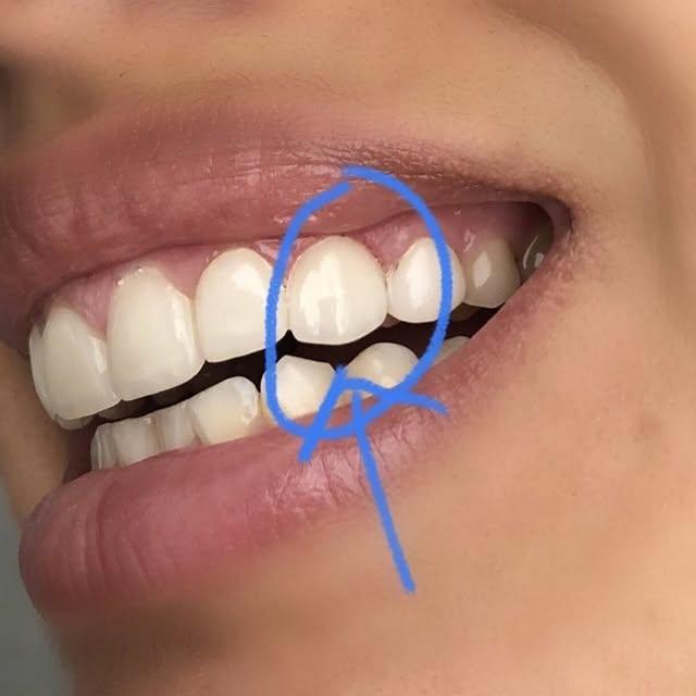 Images Smiles By Eddie: Dr. Edmond Ahdoot DDS