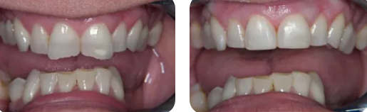 Images Paige Prather Smiles