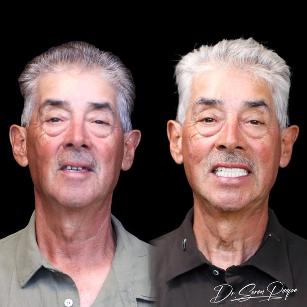 Images Smile Now Denver Dentures and Implants