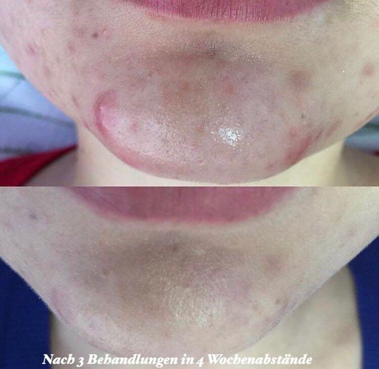 Schönheitssalon Ilaria, Eichenweg 20 in Jettingen-Scheppach