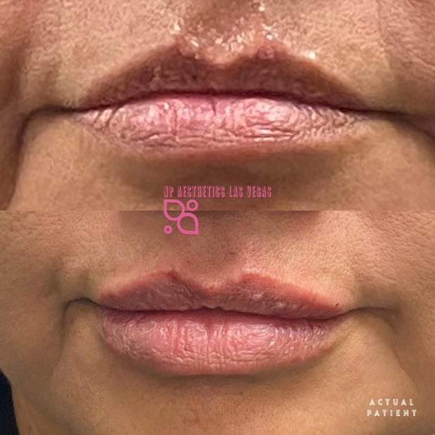 Images NP Aesthetics Las Vegas