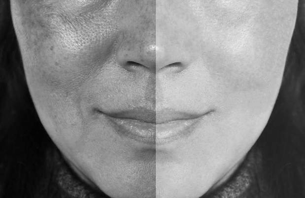 Images Lift Medical Aesthetics