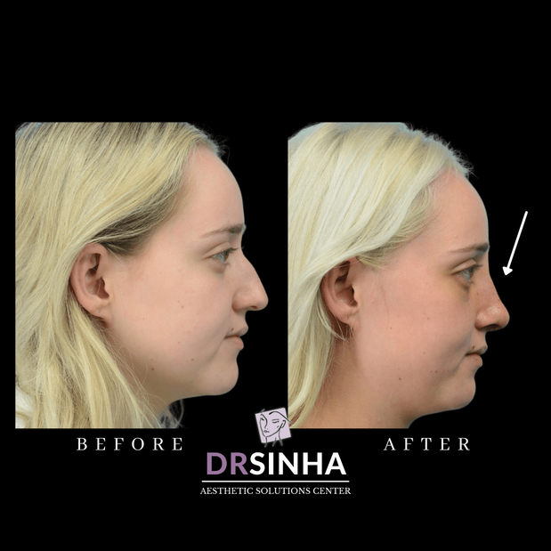 Images Pradeep K Sinha MD PhD FACS - Facial Aesthetic Surgery