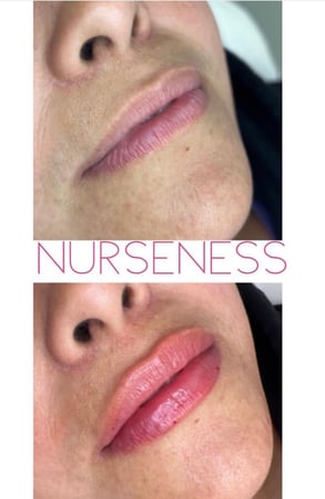 Images Central Coast Allure Medspa