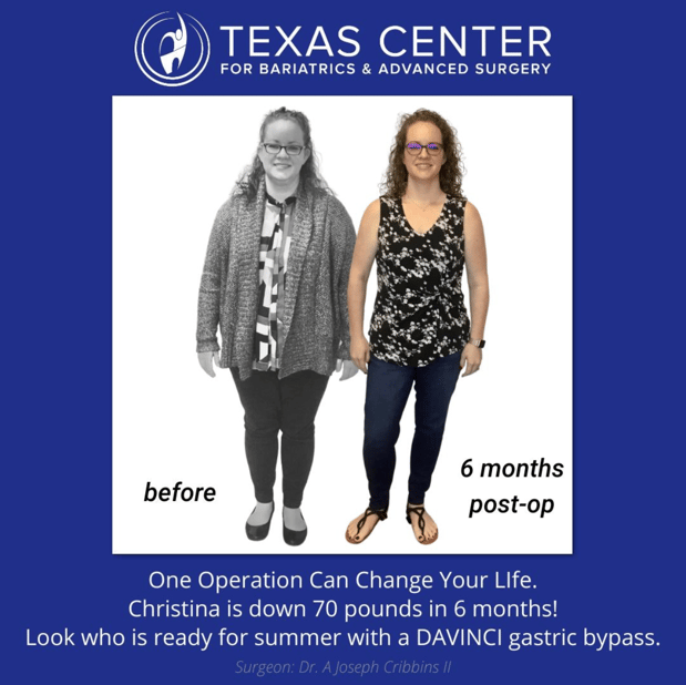 Images Texas Center for Bariatrics & Advanced Surgery