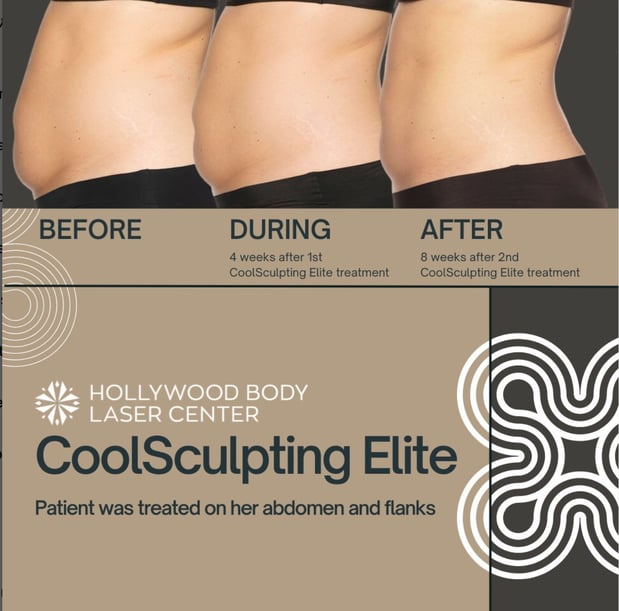 Images Hollywood Body & Face Denver/Metro
