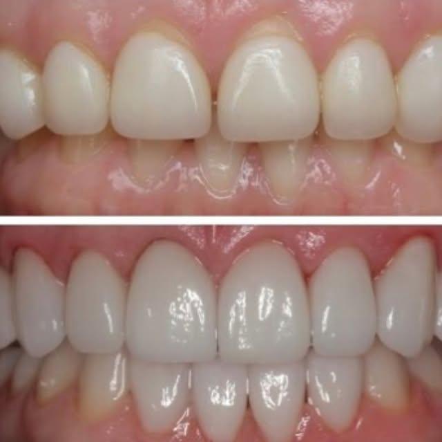 Images Smiles By Eddie: Dr. Edmond Ahdoot DDS