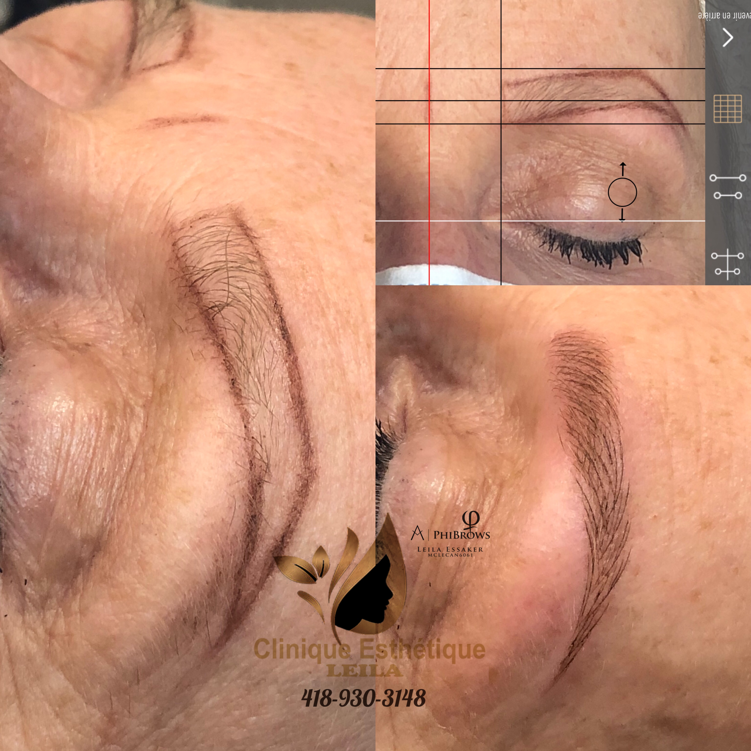 Images Clinique d'Esthétique Leila - Hydrafacial, Microblading, Épilation Laser Sainte-Foy