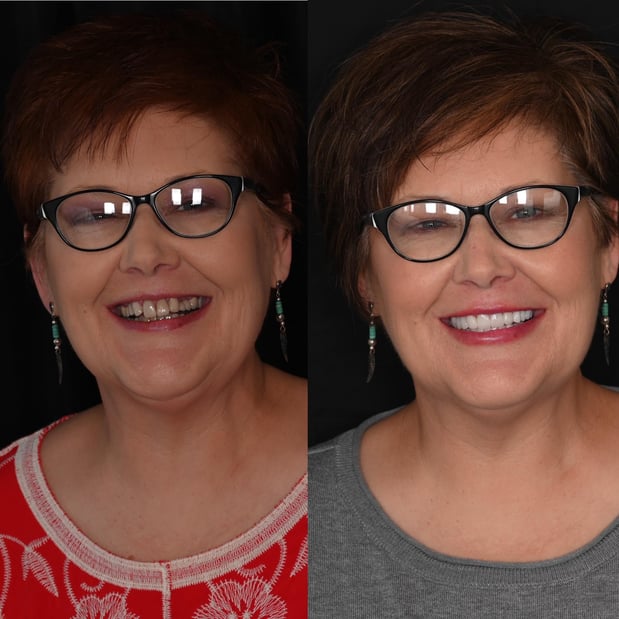 Images Nashville Wisdom Teeth and Implant Solutions