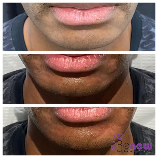 Images Renew Body Contouring & MedSpa