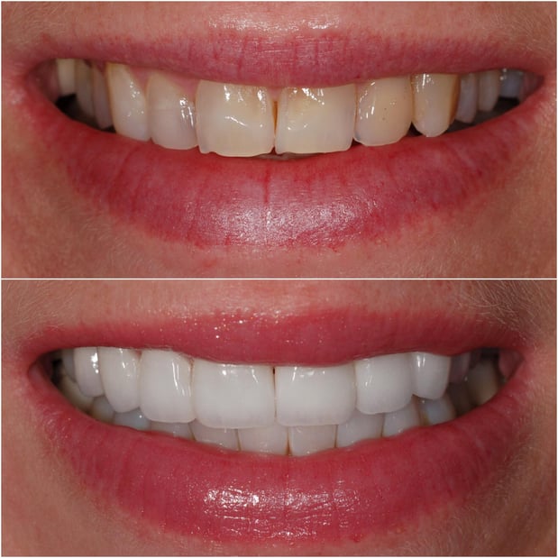 Images Pacific Dental Care