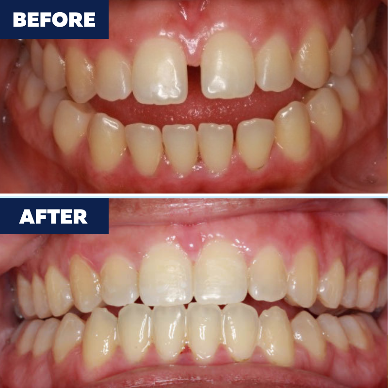 Images Gardena Orthodontics