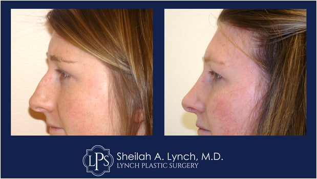 Images Sheilah A. Lynch, MD - Lynch Plastic Surgery