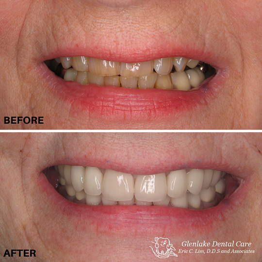 Images Glenlake Dental Care
