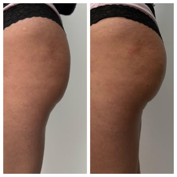 Images Body Lounge Park Cities - Whole Body Wellness & Medical Aesthetics, Dallas, TX