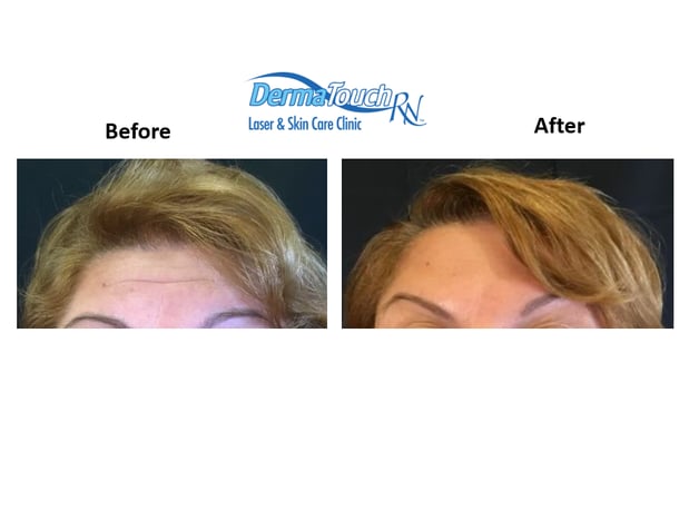 Images DermaTouch RN