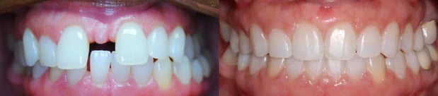 Images TLC Pediatric Dentistry and Orthodontics