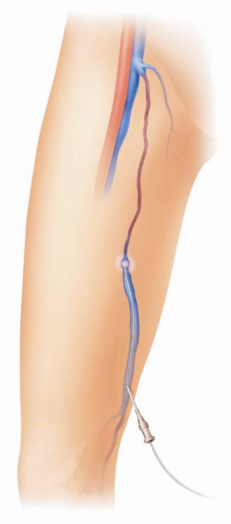 Venenzentrum - Gefäßordination Dr. Johannes Fruhwirth, Hugo-Wolf-Gasse 6a in Graz