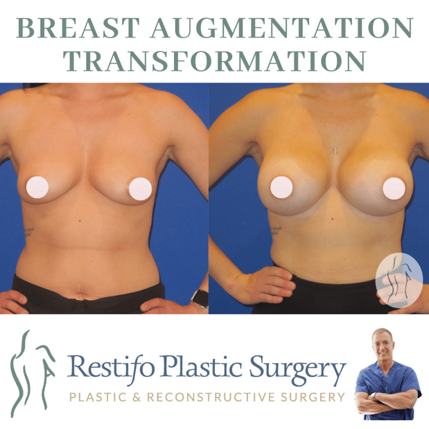 Images Restifo Plastic Surgery