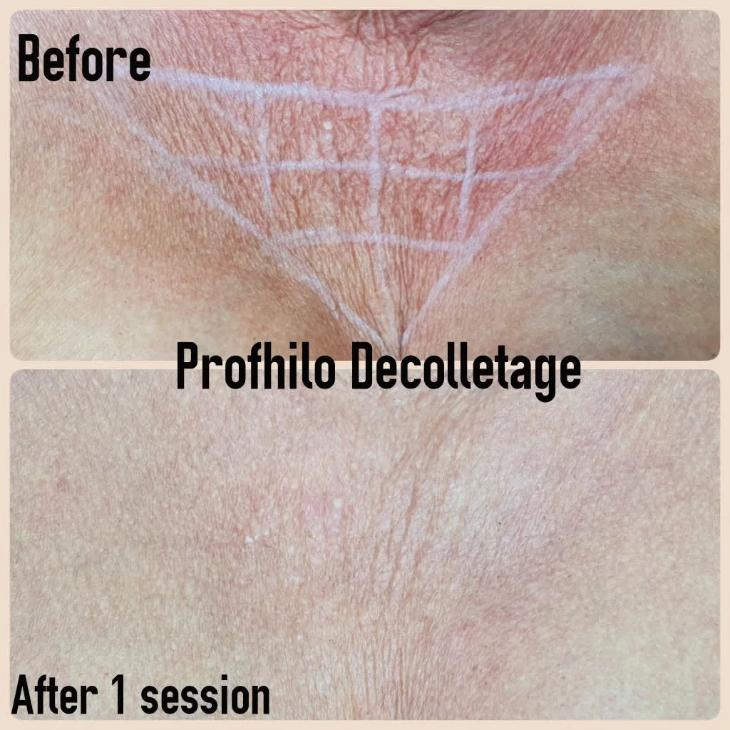 Images Lincoln Aesthetic