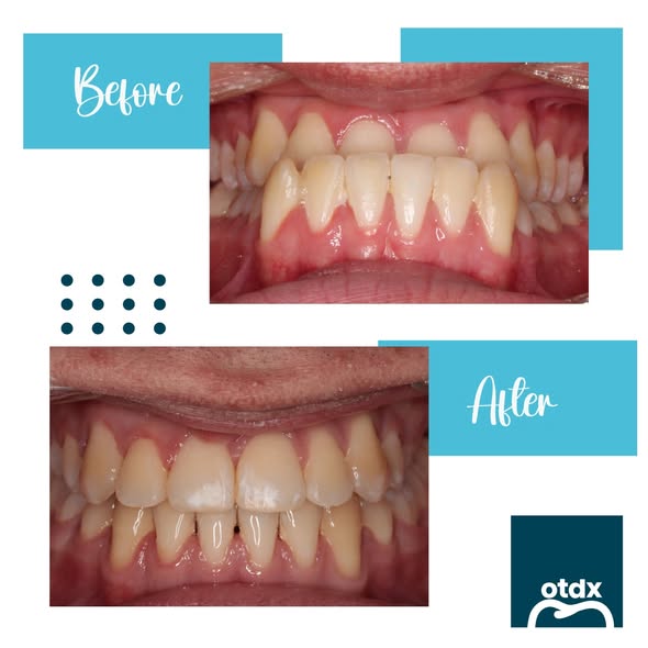 Images Orthodontix Forestville