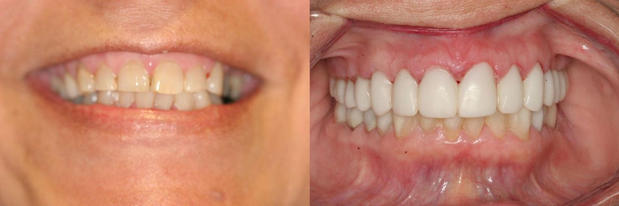 Images Delany Dental Care
