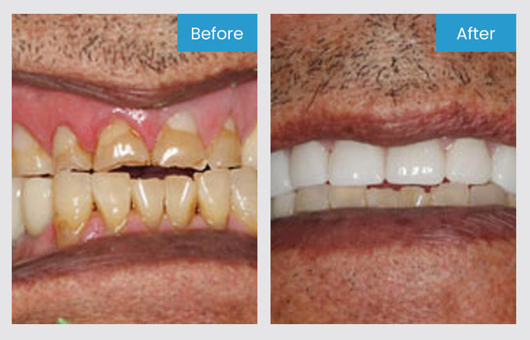 Images Katy Dentist | Smile Avenue Family Dentistry