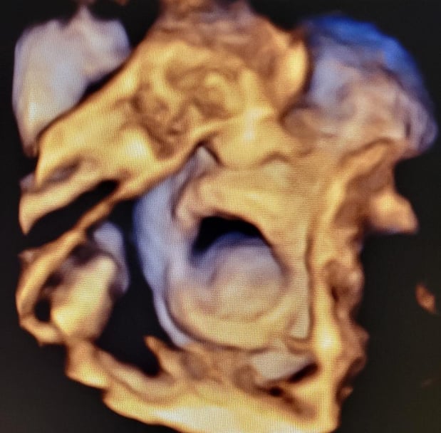 Images Love At First Sight 3D/4D Ultrasound Imaging Studio, LLC