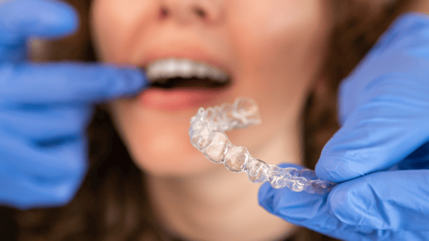 Images Diamond Braces Orthodontist: Braces & Invisalign