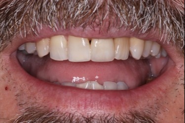 Images Melancon Family Dentistry