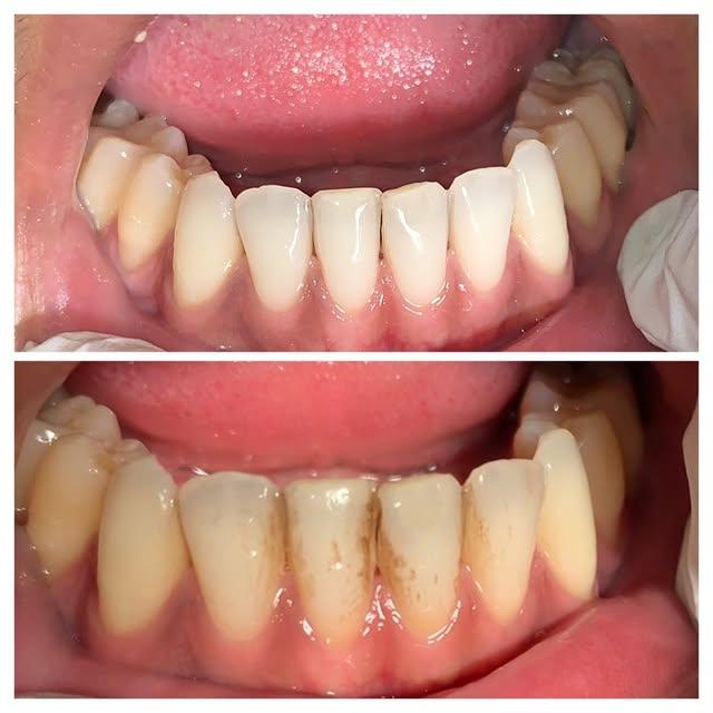 Images Smiles By Eddie: Dr. Edmond Ahdoot DDS