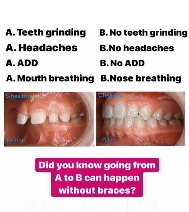 Images Lifetime Dental & Fastbraces