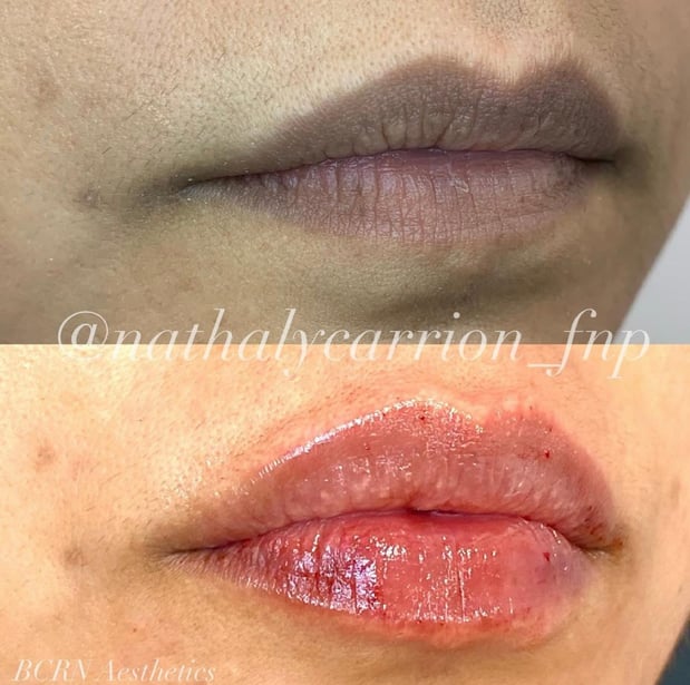 Images BCRN Aesthetics MedSpa