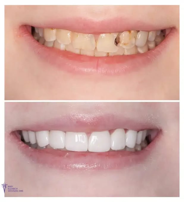 Images Mary Elizabeth Viechnicki, DMD